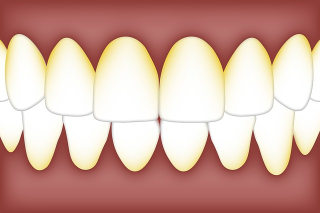 dental-3584756_640.jpg