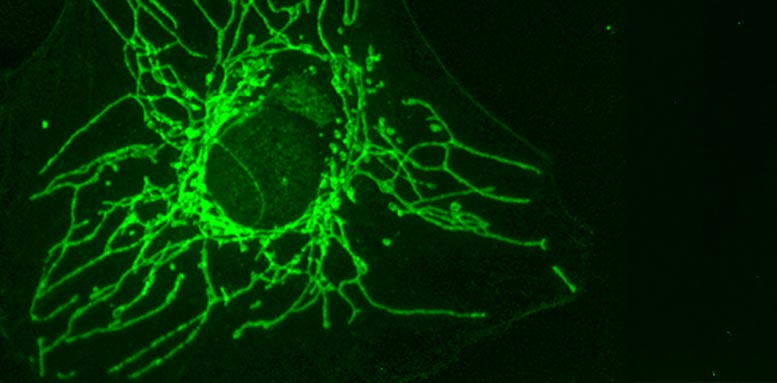 Cancer-Cell-With-Mitochondria-in-Green.jpg